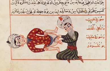 Ms Sup Turc 693 fol.76v Operatie voor castratie, 1466